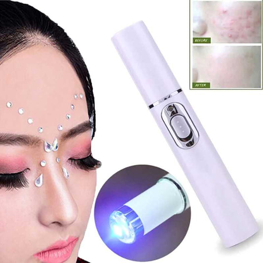 1Pc Medical blue light laser treatment pen acne scar wrinkle removal device